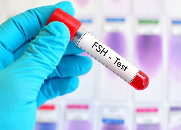 FSH hormonu nedir, rolu, normal deyeri?