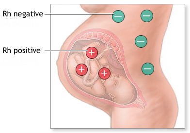 Rezus-faktor nedir?